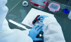 Scope Fluidics gotowe do industrializacji systemu BacterOMIC