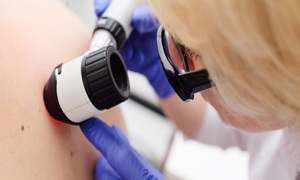 „Leczenie czerniaka w Polsce. Krok od standardów terapeutycznych” – raport