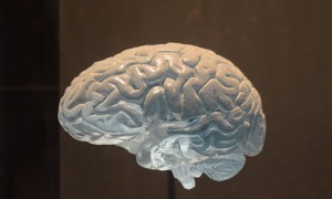 Neurologia w Polsce wymaga reformy – posiedzenie Parlamentarnego Zespołu ds. Stwardnienia R