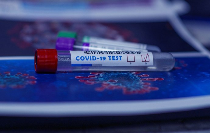 COVID-19 – nowe laboratorium diagnostyczne. Wspólna inicjatywa MIBMiK, IBB PAN, IMDiK PAN i