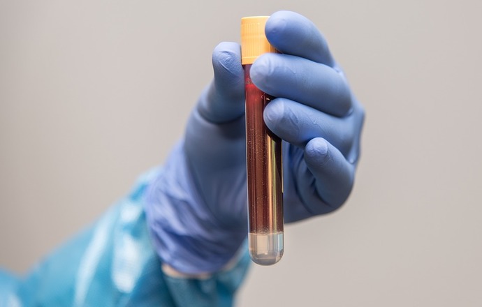 Biomed rozpocznie produkcję immunoglobuliny stosowanej w leczeniu COVID-19