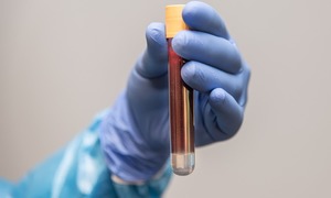 Biomed rozpocznie produkcję immunoglobuliny stosowanej w leczeniu COVID-19