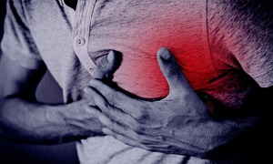 Eksperci: pamiętajmy, że zawał jest bardziej śmiertelny niż COVID-19