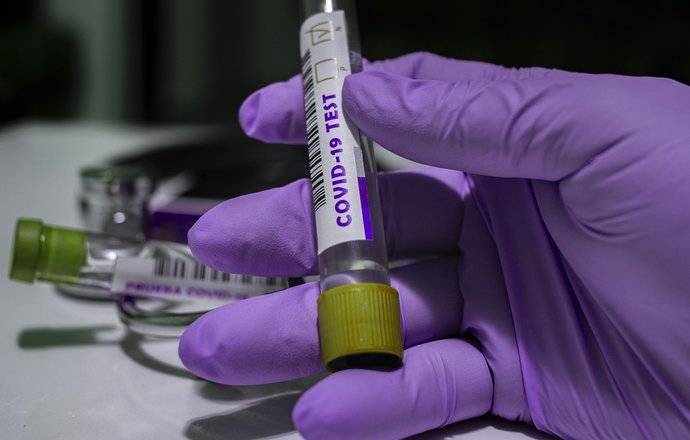 Testy diagnostyczne a epidemia COVID-19