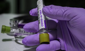 Testy diagnostyczne a epidemia COVID-19