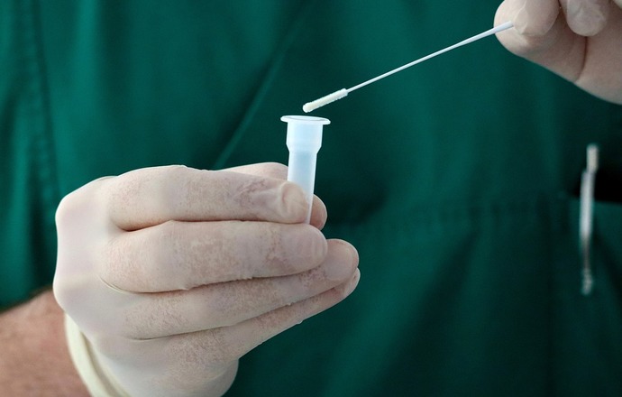 Czy nowe Rozporządzenie Ministra Zdrowia ws. testów na COVID-19 ograniczy działalność komer