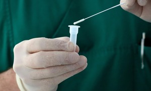 Czy nowe Rozporządzenie Ministra Zdrowia ws. testów na COVID-19 ograniczy działalność komer