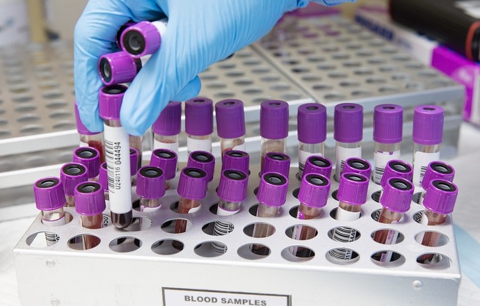 Australijscy naukowcy opracowali 20-minutowy test krwi na koronawirusa