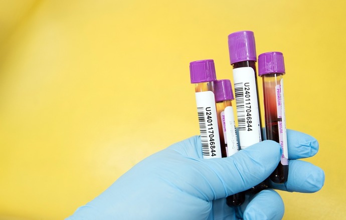 Biomed-Lublin rozpoczął wytwarzanie immunoglobuliny anty-SARS-CoV-2 z osocza ozdrowieńców