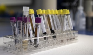 Biomed wyprodukował immunoglobulinę z osocza