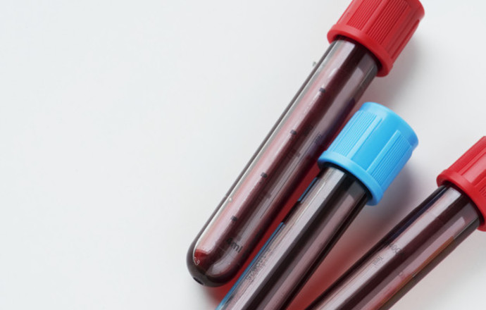 Biomed-Lublin ma pierwszy na świecie skuteczny lek na COVID-19!