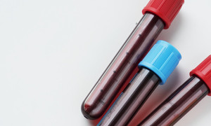 Biomed-Lublin ma pierwszy na świecie skuteczny lek na COVID-19!
