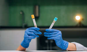 Zakażenia koronawirusem w lubelskim Biomedzie nie wpłyną na prace nad polskim lekiem na COV