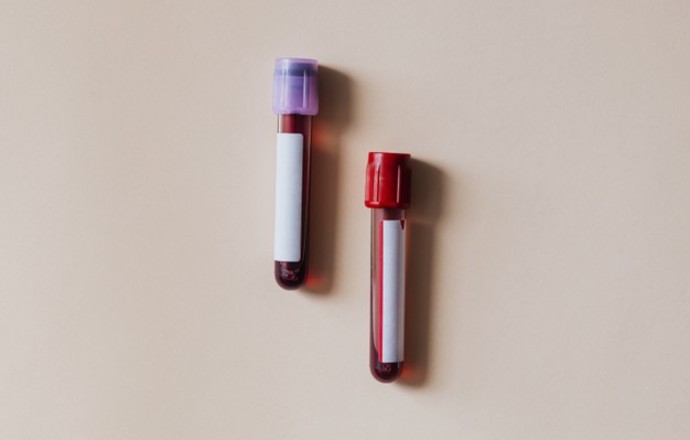 URPL wydał zgodę na badanie kliniczne immunoglobuliny anty SARS-CoV-2 Biomed-Lublin
