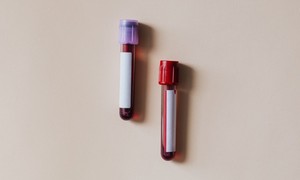 URPL wydał zgodę na badanie kliniczne immunoglobuliny anty SARS-CoV-2 Biomed-Lublin