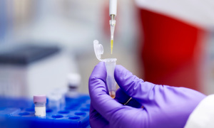 Genomtec rozpoczyna etap badań klinicznych nowego produktu – zestawu diagnostycznego do wyk