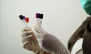 Wykorzystanie pri-miRNA jako markera w diagnostyce nowotworów głowy i szyi – sukces polskic