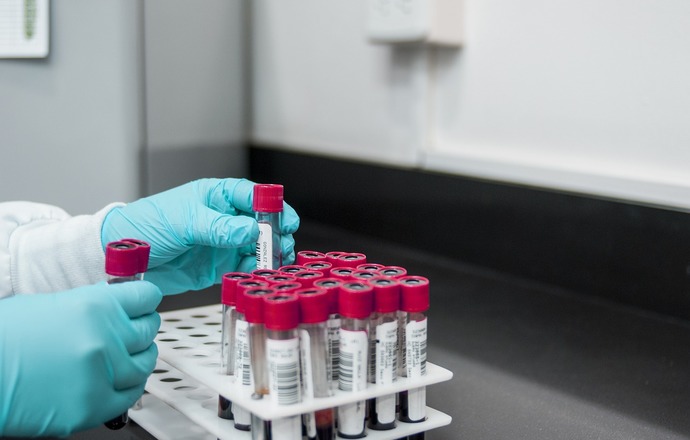 Mastocytoza – przy diagnozie kluczowa jest znajomość objawów