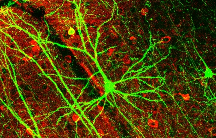 Psylocybina indukuje szybki i trwały wzrost liczby połączeń nerwowych w korze czołowej mózg