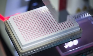 Galapagos skorzystał z prawa opcji do licencjonowania programu Ryvu Therapeutics o potencja
