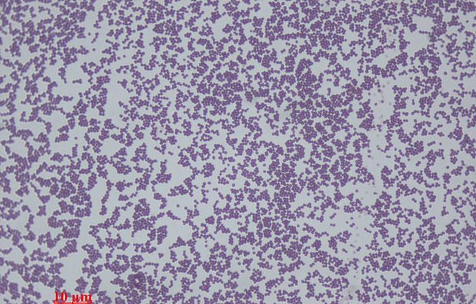 Staphylococcus epidermidis przyczynia się do utrzymania homeostazy bariery ochronnej skóry 