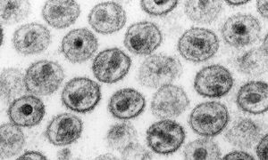 Krążek dopochwowy – rozwiązanie potencjalnie zapobiegające zarażeniu wirusem HIV
