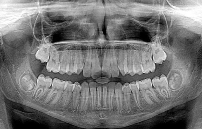 RTG punktowe, cefalometria, pantomografia – czyli cyfryzacja w stomatologii