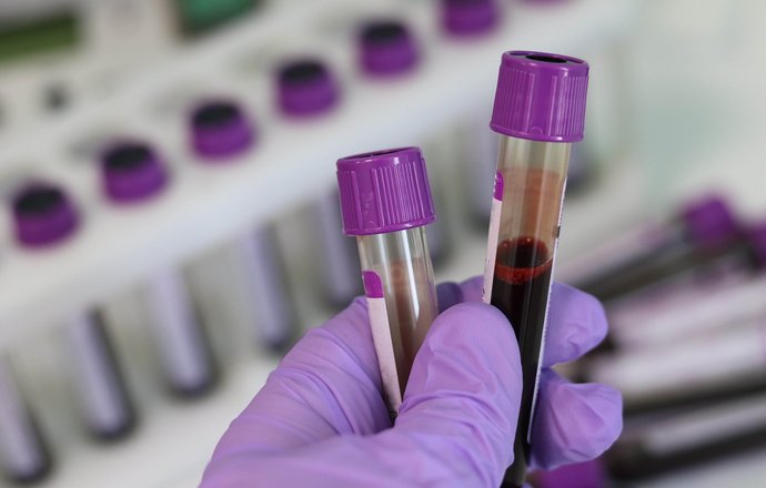 Czwarta edycja grantu naukowego Fundacji DKMS