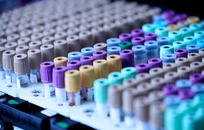Nowe rozporządzenie w sprawie wyrobów medycznych do diagnostyki in vitro – rewolucja w praw
