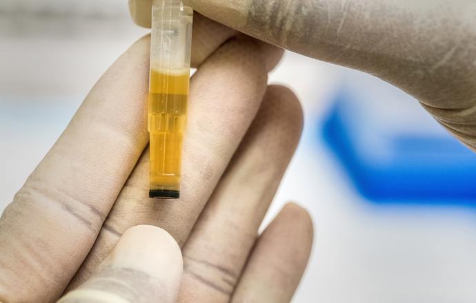 Urteste osiągnęło kamień milowy w projekcie testu diagnostycznego na raka trzonu macicy