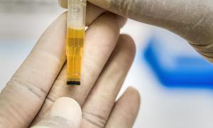 Urteste osiągnęło kamień milowy w projekcie testu diagnostycznego na raka trzonu macicy