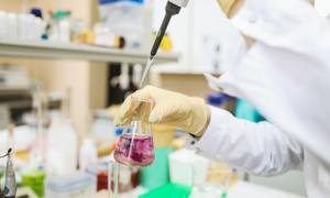 Metody stosowane w badaniu właściwości antyoksydacyjnych