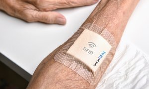 Twórcy inteligentnego opatrunku do diagnostyki stanu ran przewlekłych SmartHEAL zwycięzcami