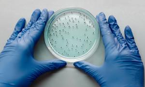 Wtórne metabolity roślinne jako środki przeciwdrobnoustrojowe