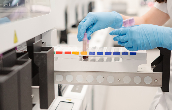 Etap przedanalityczny istotny dla wiarygodności wyników diagnostycznych badań laboratoryjny