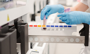 Etap przedanalityczny istotny dla wiarygodności wyników diagnostycznych badań laboratoryjny