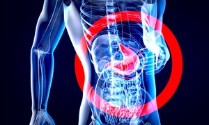 Urteste osiągnęło kamień milowy w projekcie testu diagnostycznego na raka żołądka