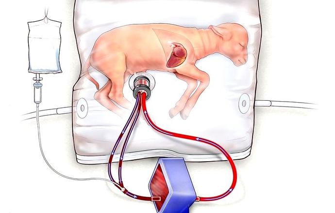 Sztuczne łożysko – innowacyjne rozwiązanie dla wcześniaków