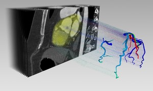 Kolejny patent dla modelowania naczyń krwionośnych przy użyciu sztucznej inteligencji