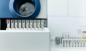 Techniki sprzężone w chemii analitycznej