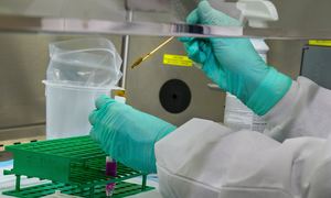 Pharmena będzie pracować nad innowacyjnym wyrobem medycznym wspomagającym gojenie się ran n