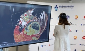 Przełomowy rok dla lekarzy i pacjentów z Instytutu Matki i Dziecka – nowe technologie ratuj