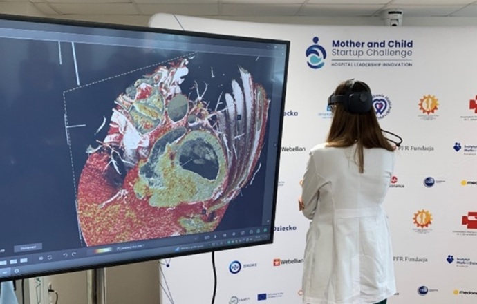 Przełomowy rok dla lekarzy i pacjentów z Instytutu Matki i Dziecka – nowe technologie ratuj