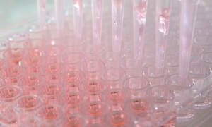 Końcówki do pipet BioClean Ultra – niezawodna diagnostyka COVID-19 i innych wirusów chorobo