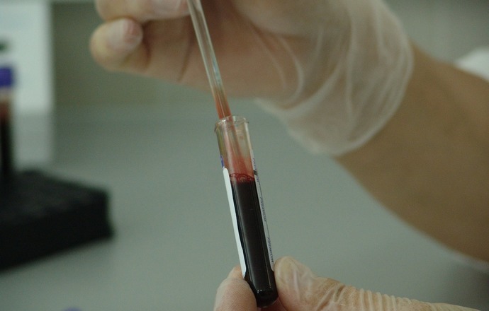 Healthnomic zakończył negocjacje z WAT i nabył prawa do metody przesiewu badania krwi onkol