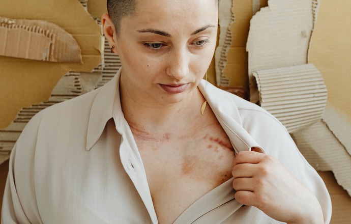 Biodruk 3D szansą na przełom w leczeniu urazów bez blizn