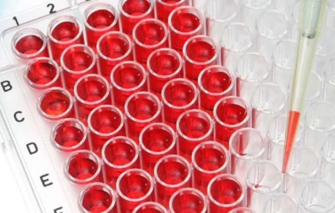 Identyfikacja bakterii przy użyciu spektroskopii Ramana – nowatorskie narzędzie w diagnosty