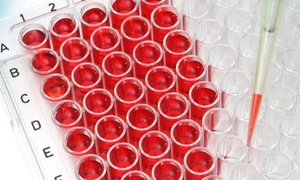 Identyfikacja bakterii przy użyciu spektroskopii Ramana – nowatorskie narzędzie w diagnosty