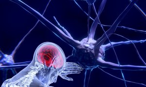 Polska spółka opracowała prototyp testu diagnostycznego wykrywającego guza mózgu