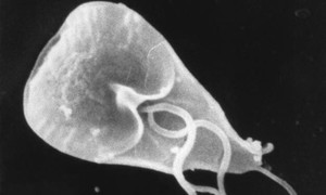 Giardioza – obraz kliniczny, diagnostyka i leczenie
